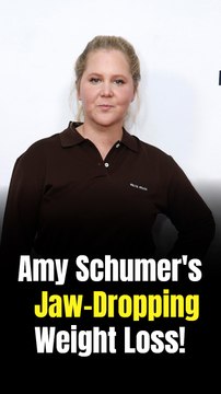 Amy Schumer Flaunts Toned Legs After Losing 30 Pounds