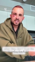 By day 3 he's completely unrecognisable 😱