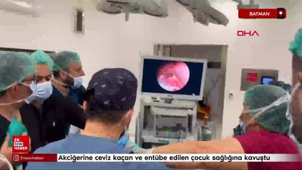 Batman'da akciğerine ceviz kaçan ve entübe edilen çocuk sağlığına kavuştu