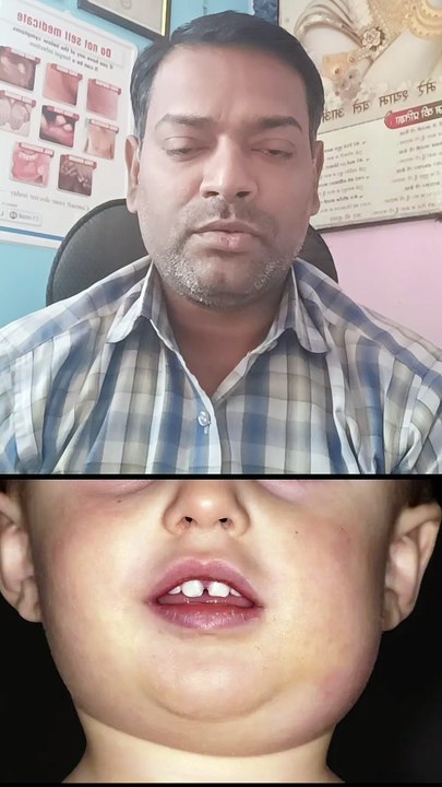 बच्चों के गले और चेहरे पर सूजन