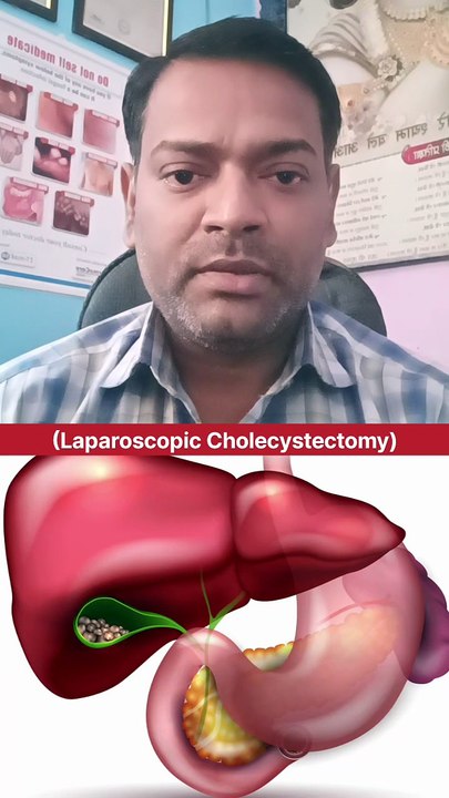 पित्ताशय की पथरी का कौन सा ऑपरेशन कराएं ।