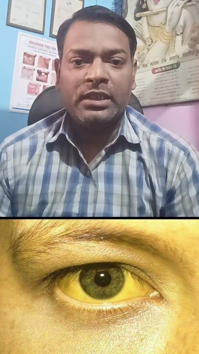 पीलिया में यह जांच कराएं ।