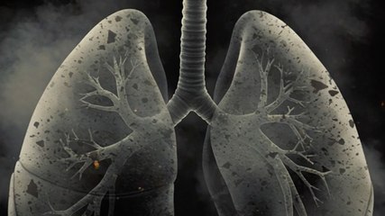 COPD बन रहा मौत का कारण
