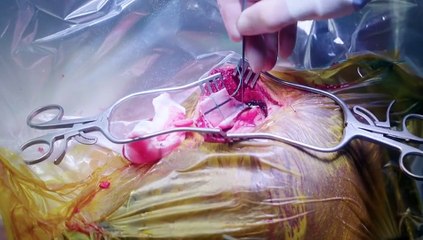 Trauma Room One - Season 2 Episode 7