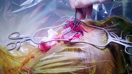 Trauma Room One - Season 2 Episode 7