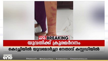 യുവമോർച്ച നേതാവ് യുവതിയെ ക്രൂരമായി മർദിച്ചു