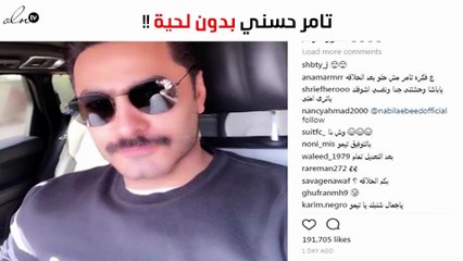 «نيولوك» جديد لتامر حسني يصدم متابعيه