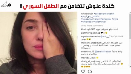 هكذا تضامنت كندة علوش مع الطفل السوري
