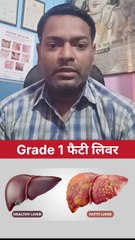 क्या बिना दवाई खाएं फैटी लीवर ठीक हो सकता है ।