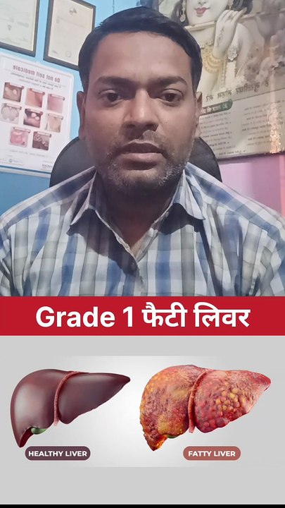 क्या बिना दवाई खाएं फैटी लीवर ठीक हो सकता है ।