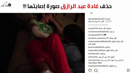 إليكم السبب الحقيقي وراء حذف غادة عبد الرازق صورة إصابتها
