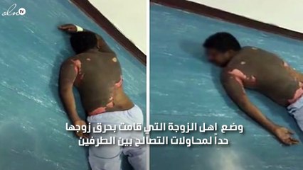 اهل الزوجة المتهمة بحرق زوجها ببيشة يرفعون دعوى قضائية على الزوج المجني عليه