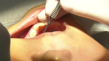 [경기] 경기 '초등생 치과주치의 사업' 7년간 79만 명 무료 검진 / YTN