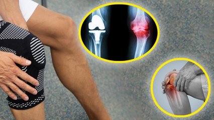 Knee Warmers For Winter:सर्दियों में घुटनों के दर्द का इलाज, नी कैप का क्या काम होता है....| Boldsky