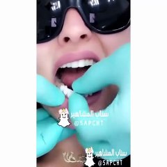 شاهدي: تسريب فيديو لمريم حسين تخضع لعملية تجميل..!!