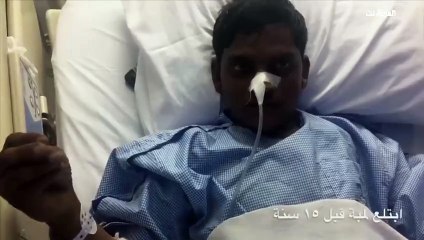 بالفيديو .. لمبة تستقر في جسد شاب سعودي لمدة 15 عاماً