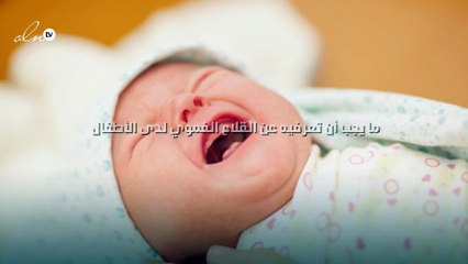 ما يجب أن تعرفيه عن القلاع الفموي لدى الأطفال