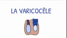 LA VARICOCÈLE expliqué simplement