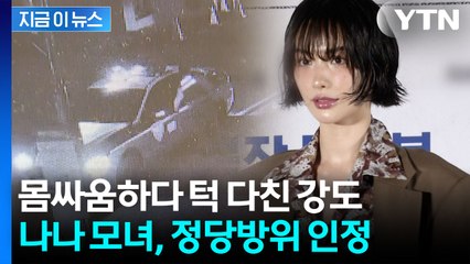 나나와 몸싸움하다 턱 다친 강도...경찰 "정당방위 맞다" [지금이뉴스] / YTN