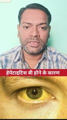 हेपेटाइटिस बी होने के कारण ।