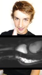 Tu te craques les doigts ?