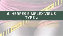 How is herpes simplex virus type 2 transmitted?