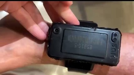 Tornozeleira de Bolsonaro tinha sinais de avaria e marcas de queimadura, diz relatório