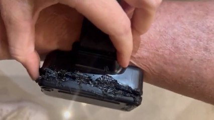 Corte Suprema revela que Jair Bolsonaro intentó quemar su tobillera electrónica con un soldador