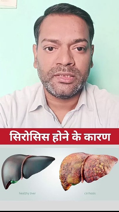 सिरोसिस ।