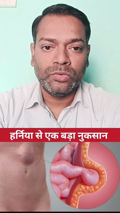 हर्निया