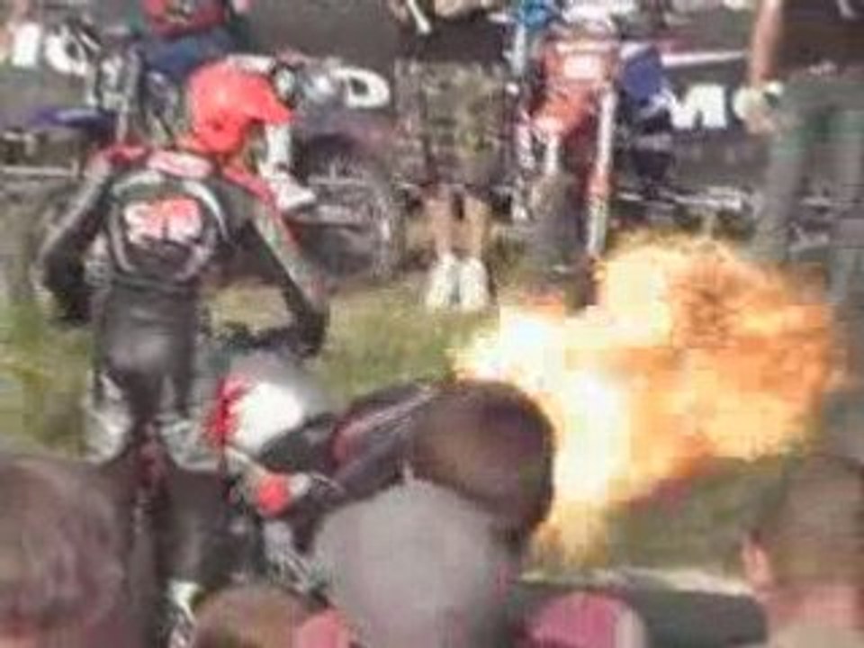 moto,rupteur, burns.