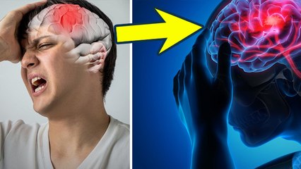 Stroke Warning Signs : स्ट्रोक आने से पहले दिखने वाले संकेत और बचाव| Paralysis Ke Lakshan | Boldsky