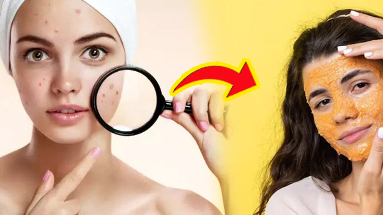Dark Spot Treatment Home Remedy:Dark Spots Kais...