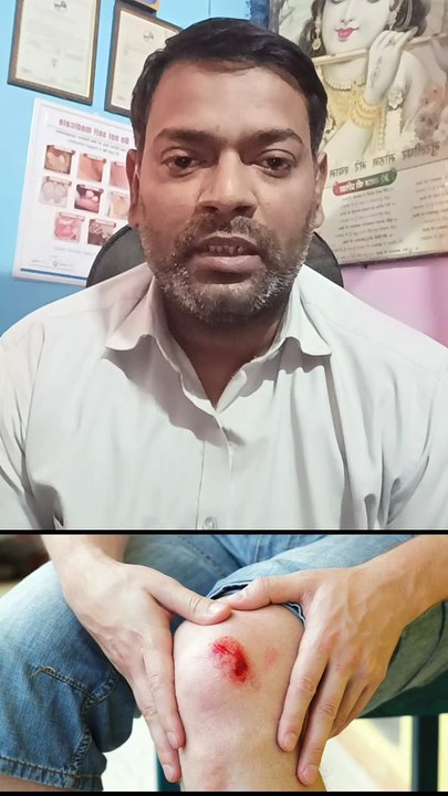 घाव ठीक न हो तो ये जांच कराएं ।