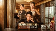 Cicatrices Frescas,Viejas Heridas