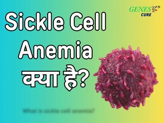 What is Sickle Cell Anemia? | Causes, Symptoms & Prevention