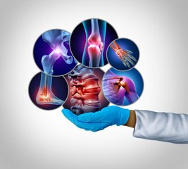 Cure su misura per le malattie reumatologiche