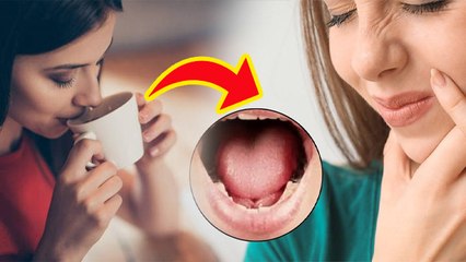 Subah Muh Sukhta Hai To Kya Karen: सुबह उठकर मुंह क्यों सूखता है?Dry Mouth Remedy & Causes | Boldsky