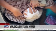Sin derechos, sin atención médica y sin justicia: la realidad de las mujeres en México