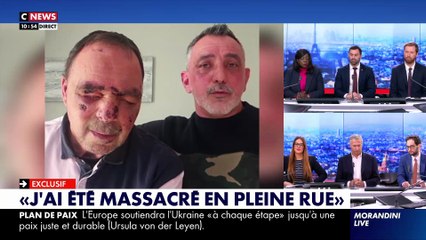 Témoignage exclusif dans "Morandini Live " de Laurent, massacré gratuitement en pleine rue - VIDEO
