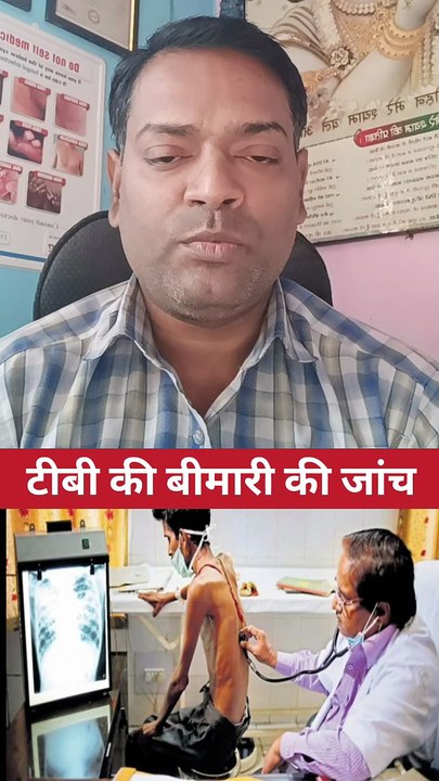 टीबी