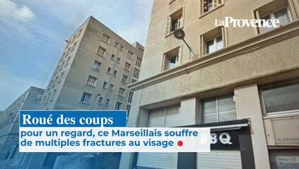 Roué de coups pour une histoire de regard, un Marseillais souffre de multiples fractures au visage