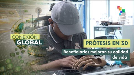 Avanza la tecnología médica en Honduras con las prótesis en 3D