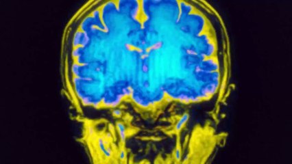 The Life of an Undocumented Worker with Seizures - Alo Short Film