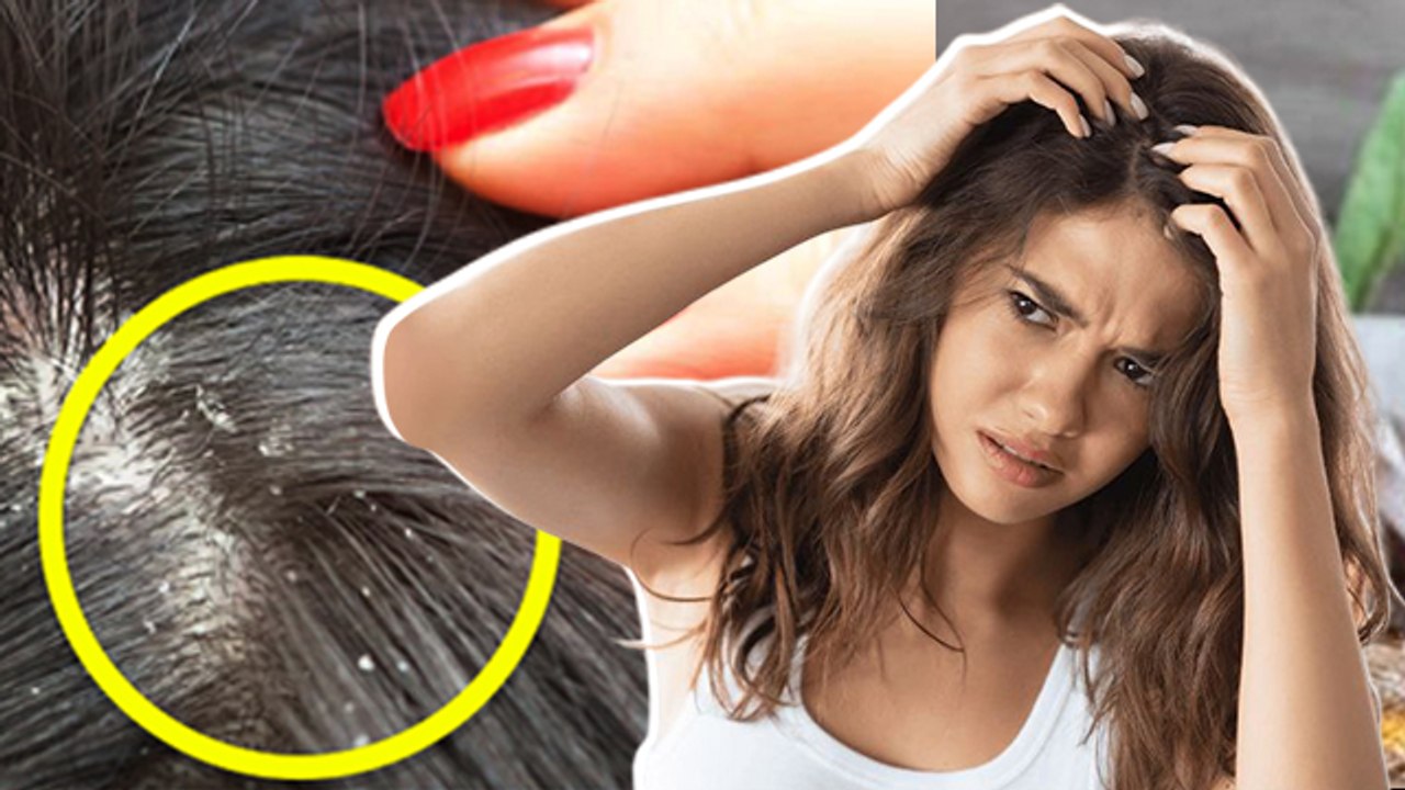 Apple Cider Vinegar: Apple Cider Vinegar Ke Fayde Kya Hain |Apple Cider Vinegar For Dandruff Removal