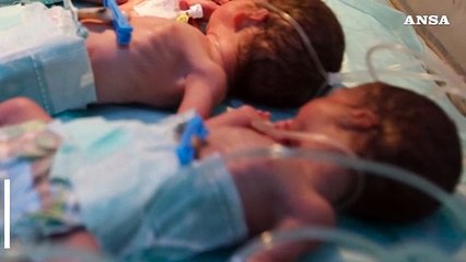 Istat, nel 2025 possibile nuovo record negativo di nascite