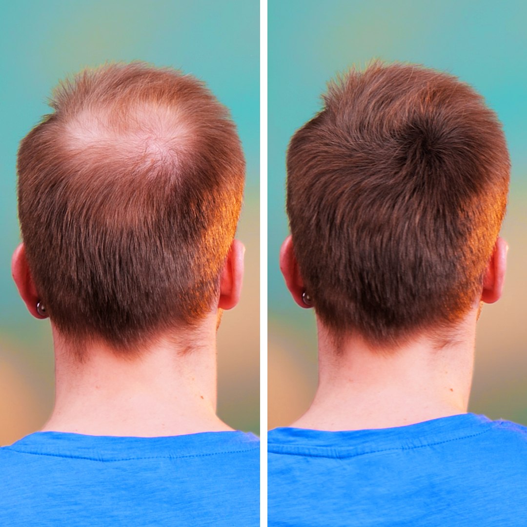 ⁣New hair , new you! learn hw to get the bests hairstyles! #beauty #hairtok #hairstyle #fyp #hacks