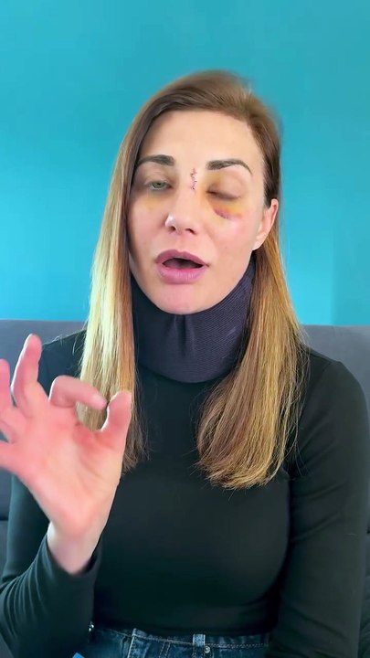 Ariane Brodier sort de son silence : «Un homme que je ne connais pas m’a agressée» - VIDEO