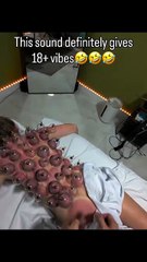 So, do you like vacuum cups