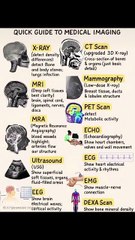 Important Images Must Know(MP4)